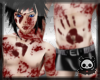 [Dead]Bloodymess skin