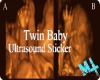 Twin Baby Ultrasound Sti