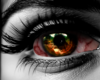 *D* Infected Hazel