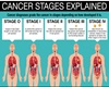 S.O.S. Cancer Awareness1