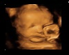 Baby's Ultrasound Framed