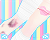 bruises ✮