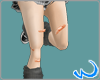 ~S] Booboo Bandaid Legs
