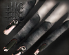 â§ rotten fingers