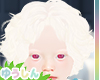 Duncan Albino