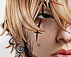 Scar