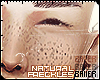 Natural Freckles