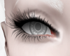 Albino Eyes