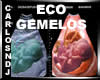 Ecosonograma Gemelos V2