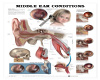 LUVI MIDDLE EAR POSTER