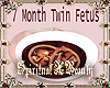 7 Month Twins In Tummy