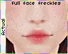 ☯ Freckles 2