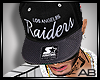 AB*  Snapback