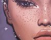 face freckles