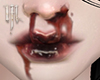 Nose Bleed ~Poppy~