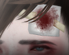 Wounded v2