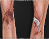 $ Bruised Knees