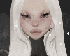 allergies