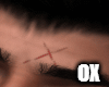 OX Asteri Scar