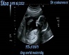 DIVA 3 MONTH ULTRASOUND