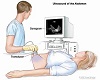 ULTRASOUND MEDICAL+SD