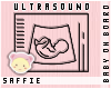 BoB | Ciara Ultrasound