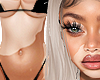 Vitiligo Skin MH