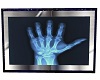 Medical Hand X-Ray