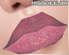 *MD*Rosa Jelly Lips|7