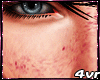 Freckles►M