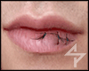 s. Injury to lips Asriel