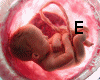 ETE FETUS IN THE WOMB