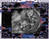 Luchima 8week ultrasound