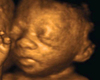 Framed Ultrasound Pic