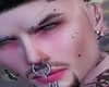 @300 MICRODERMAL