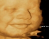 Smiling Baby Ultrasound
