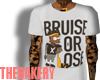 The Bruise Or Lose Tee