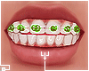 †. M Teeth 155