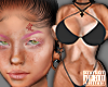 Vitiligo F| Skin