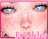 Freckles BIMBO KAWAII H