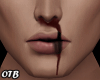 R&B► Nose Bleed