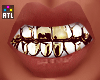 †. Teeth 85