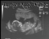 Its A Boy!!!! Ultrasound