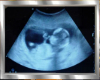 Ultrasound Scan Frame NB