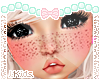 Freckles KIDS