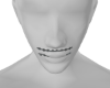 add braces