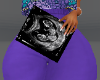 Preg Twin Ultrasound 4