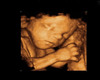 Ultrasound Picture