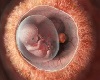 fetus orbe