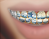 WAVES MOSAIC GRILLZ
